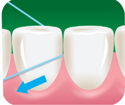 11 Escove a superfície do dente que usamos para mastigar. O movimento é suave, de vaivém. A escova deve ir até os últimos dentes do fundo da boca.