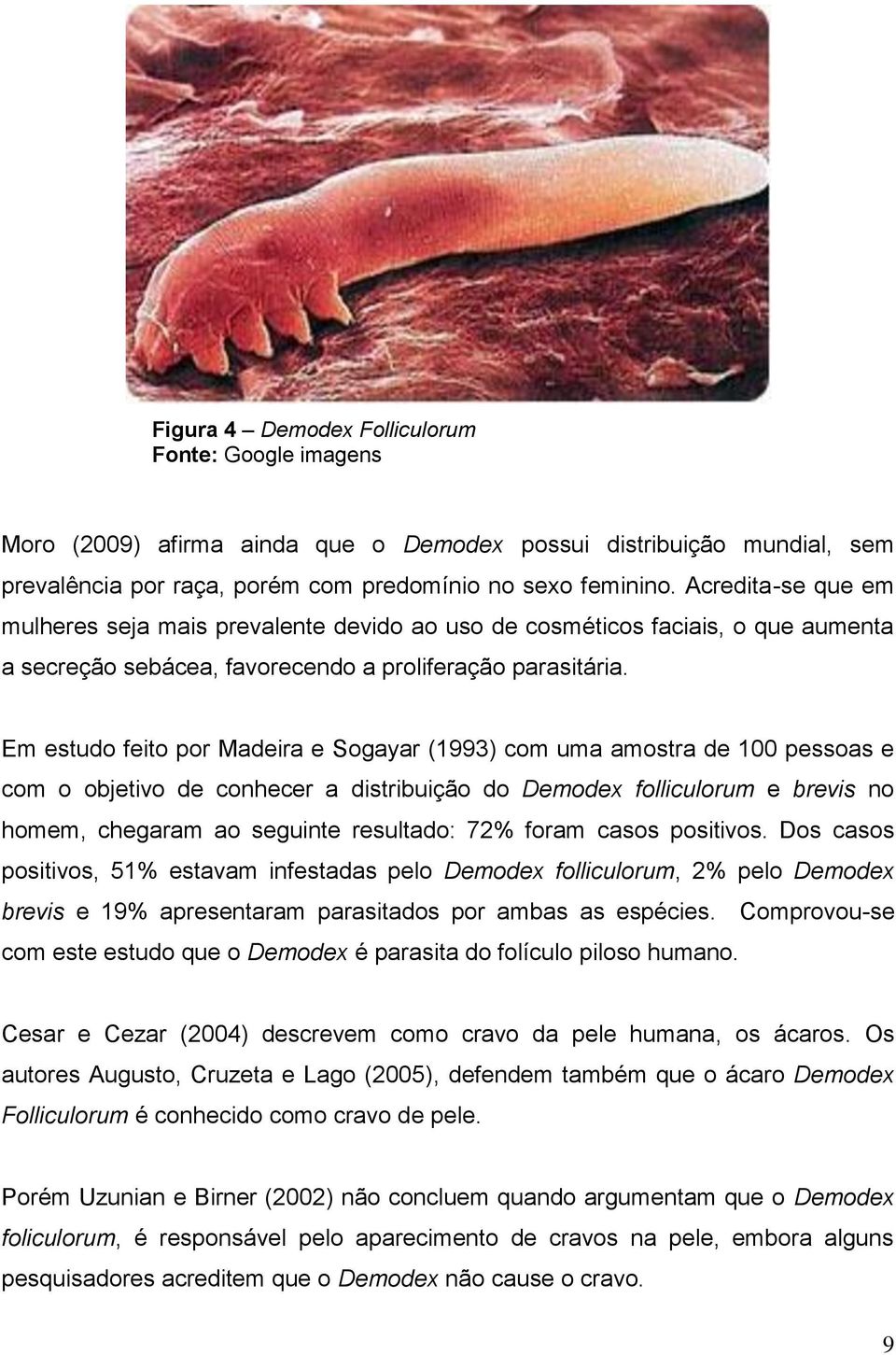 Em estudo feito por Madeira e Sogayar (1993) com uma amostra de 100 pessoas e com o objetivo de conhecer a distribuição do Demodex folliculorum e brevis no homem, chegaram ao seguinte resultado: 72%