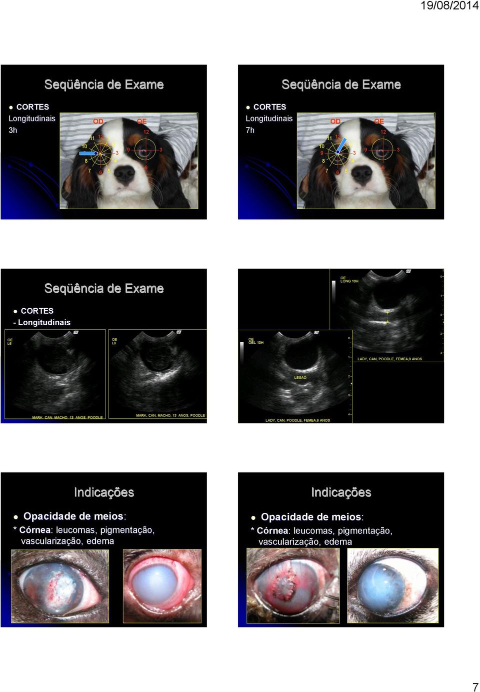 Longitudinais Seqüência de Exame Opacidade de meios: * Córnea: leucomas, pigmentação,