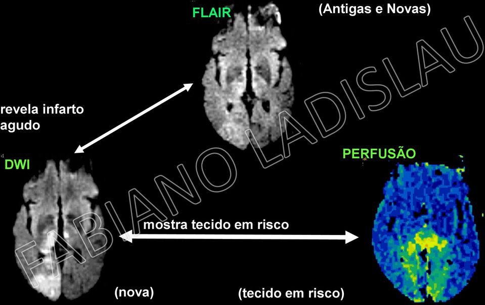 PERFUSÃO mostra tecido em