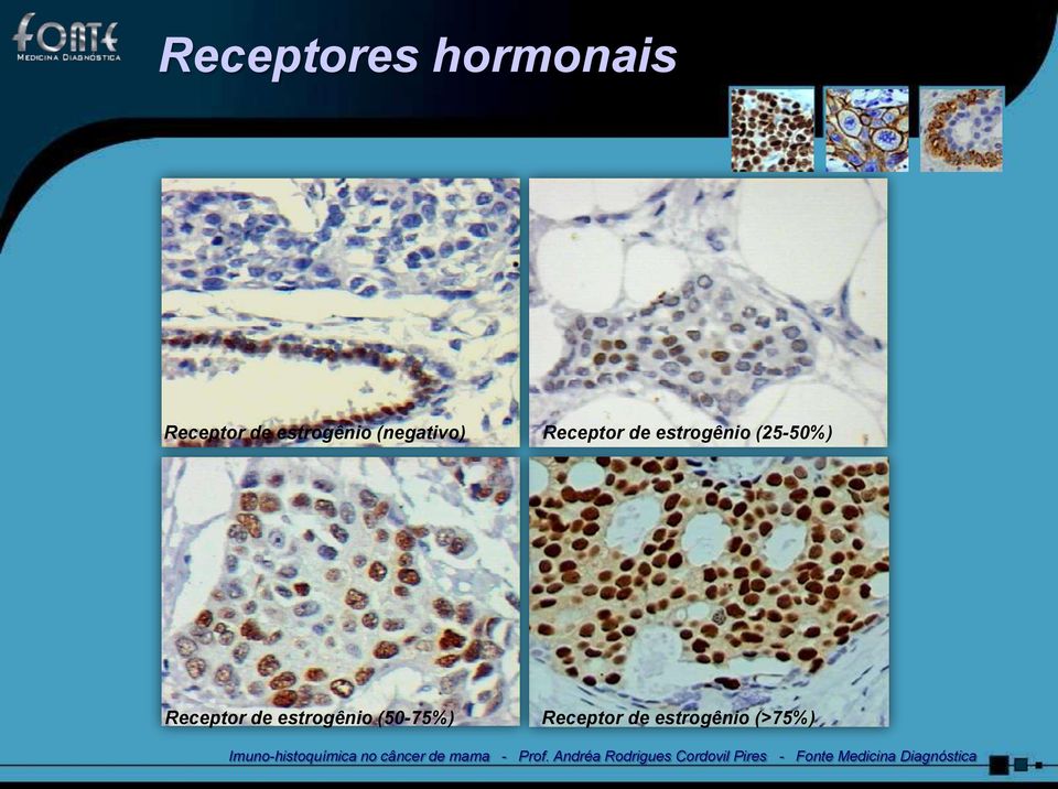 estrogênio (25-50%) Receptor de