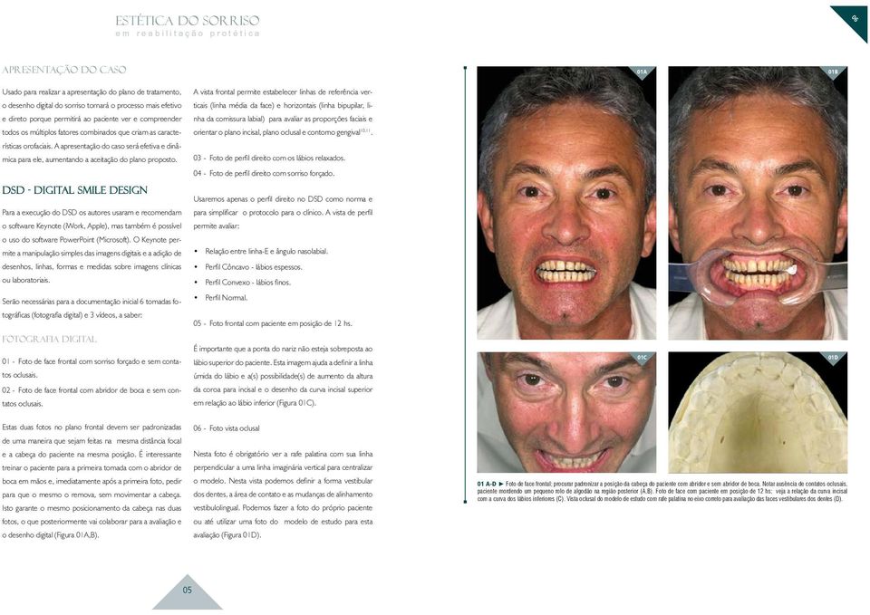 faciais e todos os múltiplos fatores combinados que criam as caracte- orientar o plano incisal, plano oclusal e contorno gengival 10,11. rísticas orofaciais.