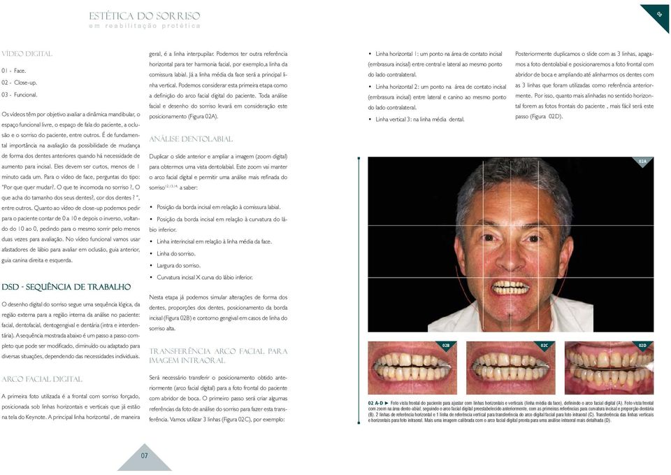 É de fundamental importância na avaliação da possibilidade de mudança de forma dos dentes anteriores quando há necessidade de aumento para incisal. Eles devem ser curtos, menos de 1 minuto cada um.