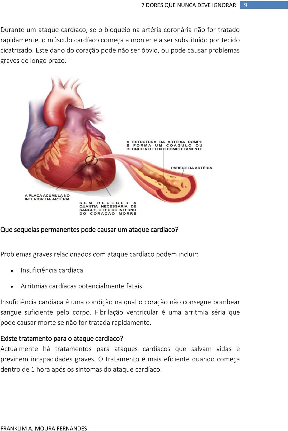 Problemas graves relacionados com ataque cardíaco podem incluir: Insuficiência cardíaca Arritmias cardíacas potencialmente fatais.
