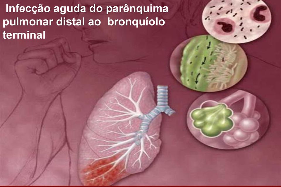 do parênquima pulmonar