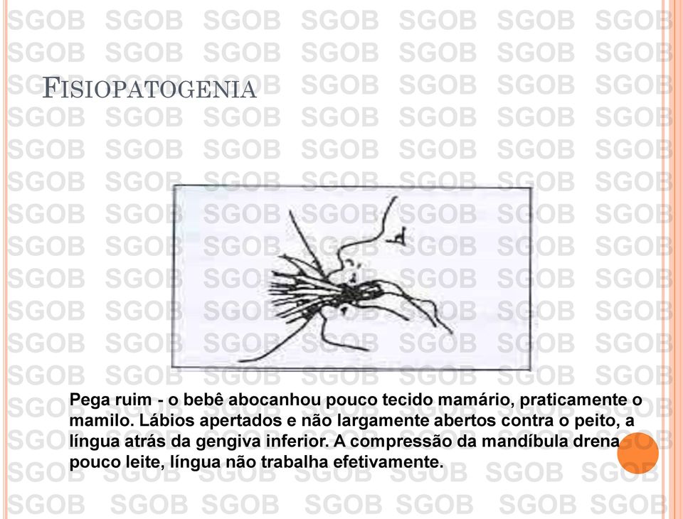 Lábios apertados e não largamente abertos contra o peito, a