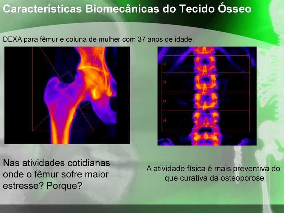 Nas atividades cotidianas onde o fêmur sofre maior estresse?