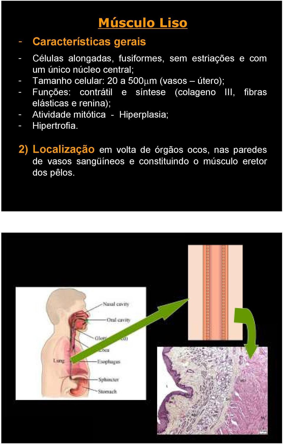 (colageno III, fibras elásticas e renina); - Atividade mitótica - Hiperplasia; - Hipertrofia.