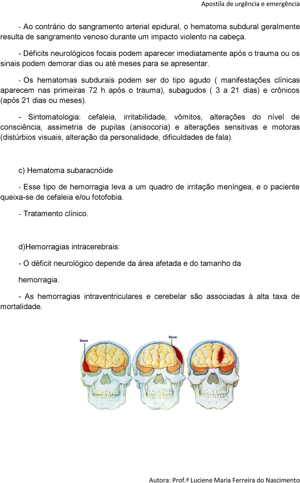 - Os hematomas subdurais podem ser do tipo agudo ( manifestações clínicas aparecem nas primeiras 72 h após o trauma), subagudos ( 3 a 21 dias) e crônicos (após 21 dias ou meses).