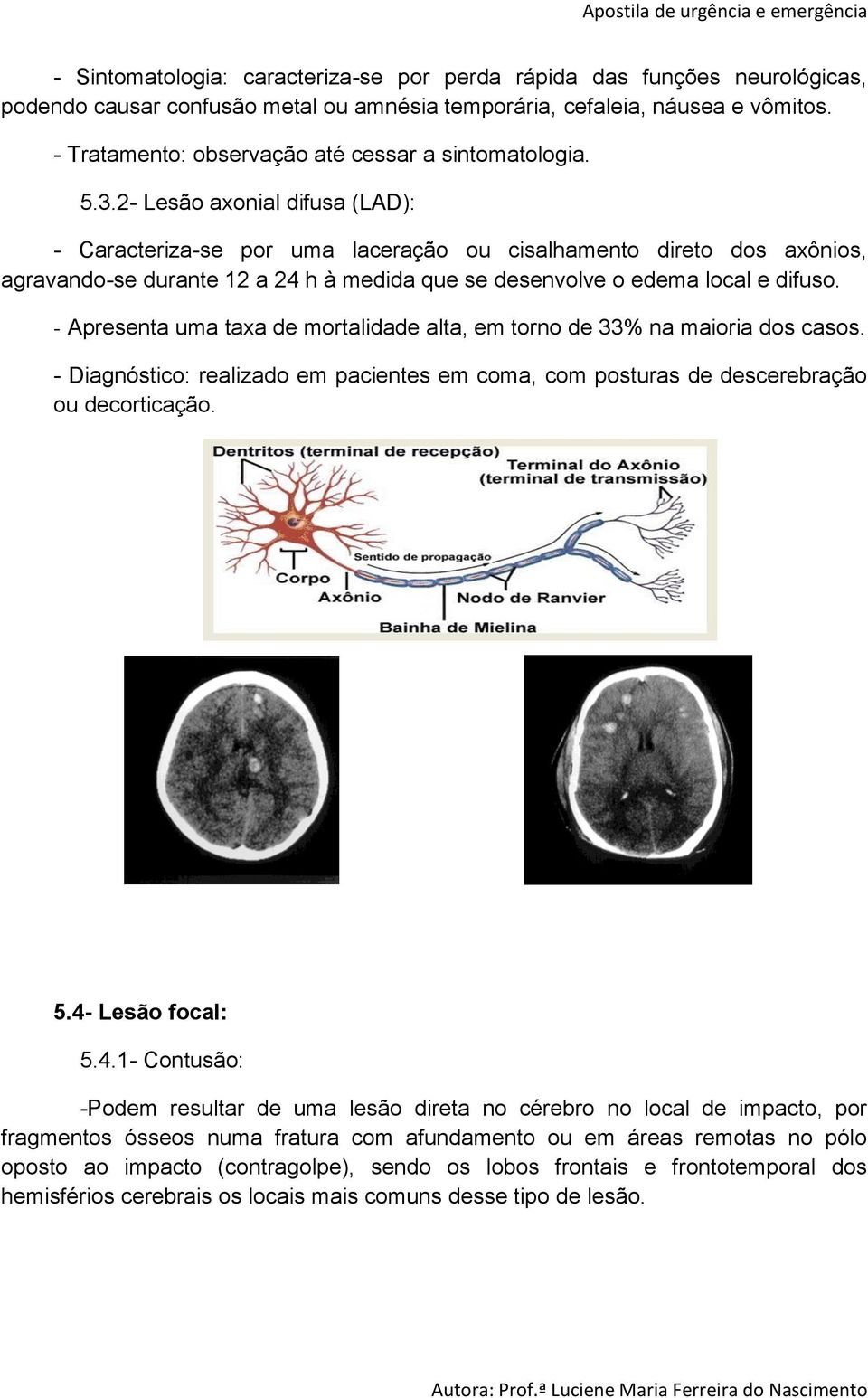 2- Lesão axonial difusa (LAD): - Caracteriza-se por uma laceração ou cisalhamento direto dos axônios, agravando-se durante 12 a 24 h à medida que se desenvolve o edema local e difuso.