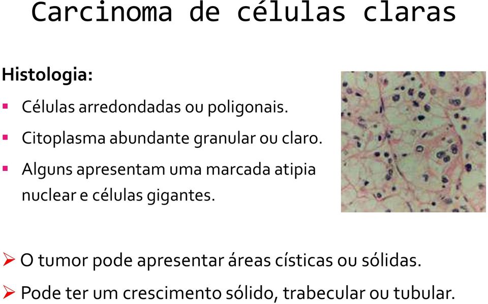 Alguns apresentam uma marcada atipia nuclear e células gigantes.