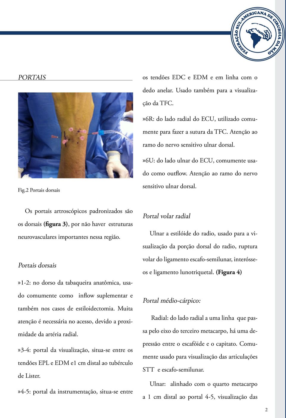 Os portais artroscópicos padronizados são os dorsais (figura 3), por não haver estruturas neurovasculares importantes nessa região.