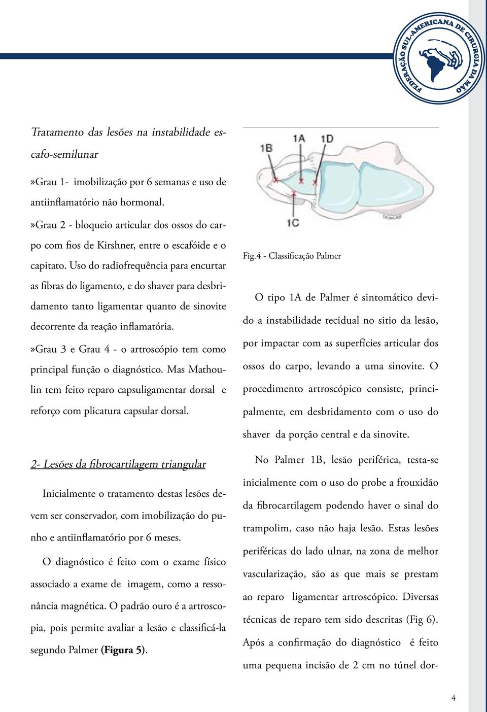 Uso do radiofrequência para encurtar as fibras do ligamento, e do shaver para desbridamento tanto ligamentar quanto de sinovite decorrente da reação inflamatória.