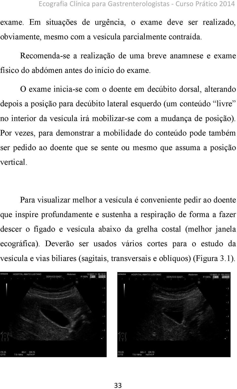 O exame inicia-se com o doente em decúbito dorsal, alterando depois a posição para decúbito lateral esquerdo (um conteúdo livre no interior da vesícula irá mobilizar-se com a mudança de posição).