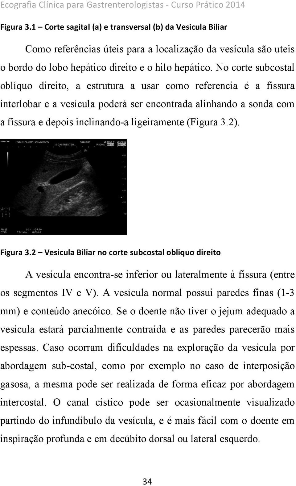 No corte subcostal oblíquo direito, a estrutura a usar como referencia é a fissura interlobar e a vesícula poderá ser encontrada alinhando a sonda com a fissura e depois inclinando-a ligeiramente