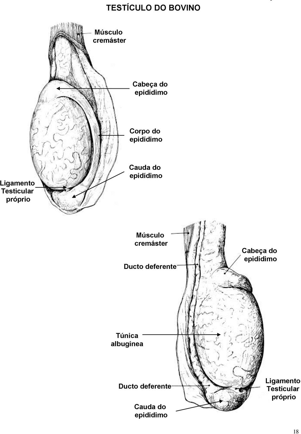 Músculo cremáster Ducto deferente Cabeça do epidídimo Túnica