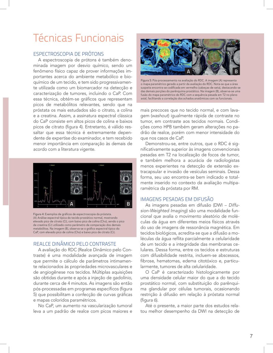 Com essa técnica, obtém-se gráficos que representam picos de metabólitos relevantes, sendo que na próstata os mais estudados são o citrato, a colina e a creatina.