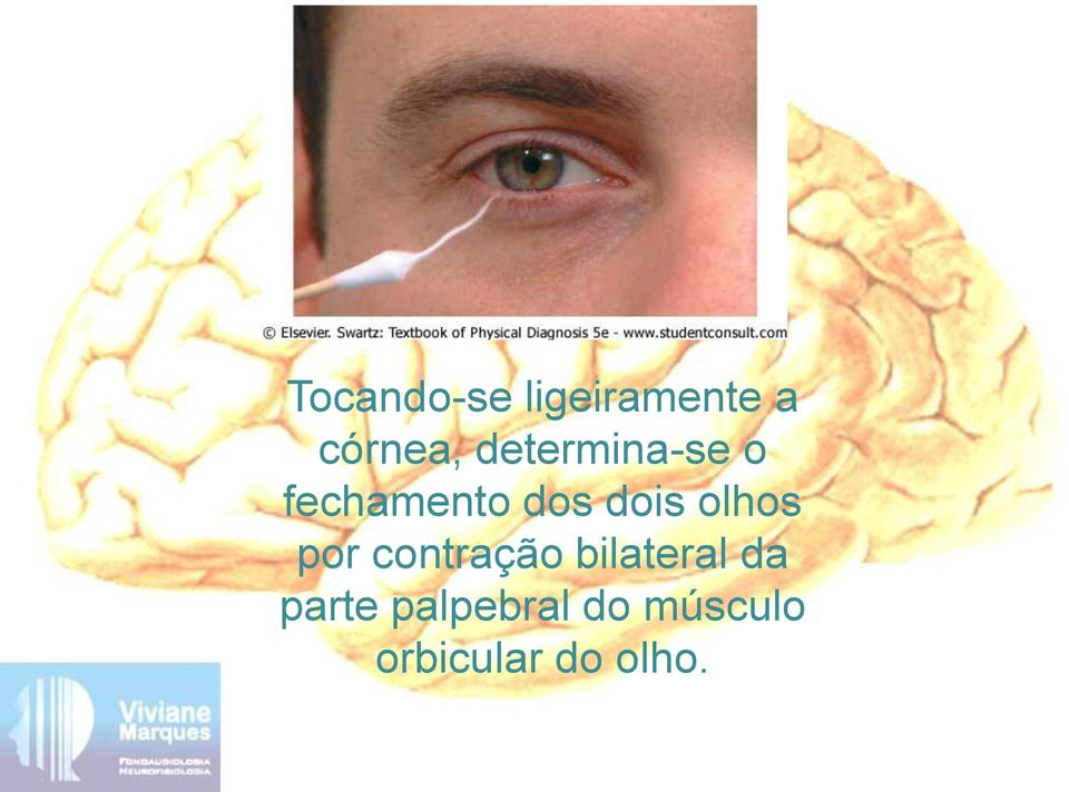 olhos por contração bilateral da