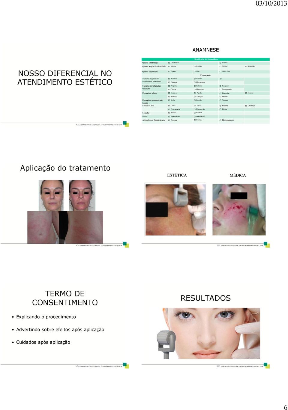 Petéquias vasculares 1 Cianose 1 Hematoma 1 Telangectasias Formações sólidas 1 Ceratose 1 Papulas 1 Comedão 1 Necrose 1 Nódulos 1 Verrugas 1 Millium Formações com conteúdo 1 Bolha 1 Pústula 1