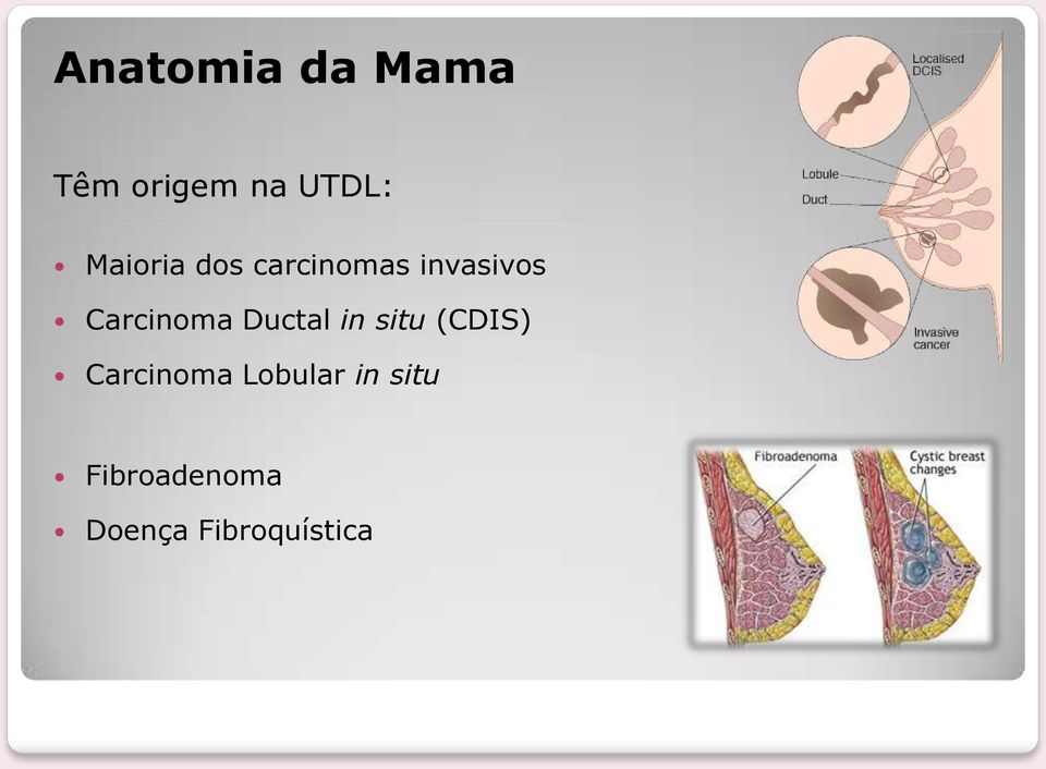 Carcinoma Ductal in situ (CDIS)