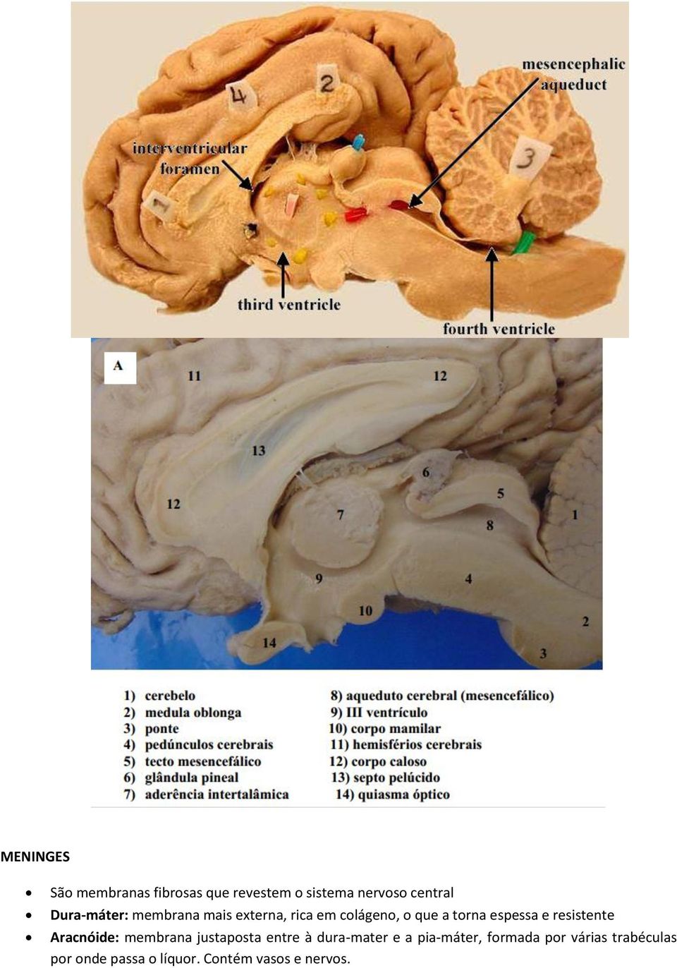 e resistente Aracnóide: membrana justaposta entre à dura-mater e a