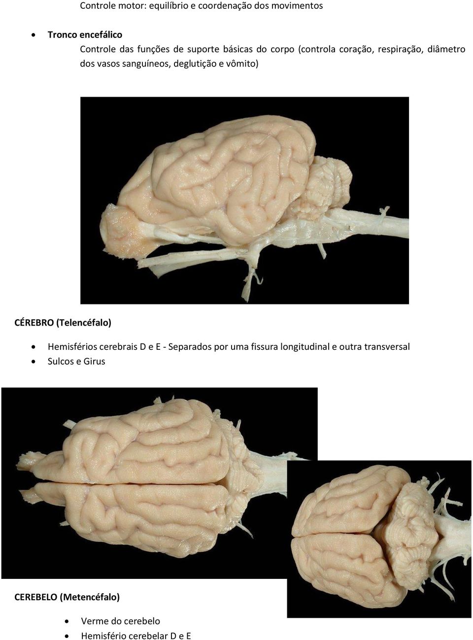 vômito) CÉREBRO (Telencéfalo) Hemisférios cerebrais D e E - Separados por uma fissura longitudinal