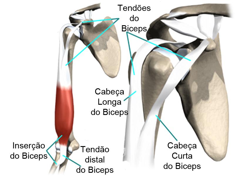 Rotura do Cabo Longo do Bíceps Introdução A rotura do bíceps envolve uma lesão completa do principal tendão que conecta o músculo bíceps ao ombro, este tendão chama-se Cabo Longo do Biceps.