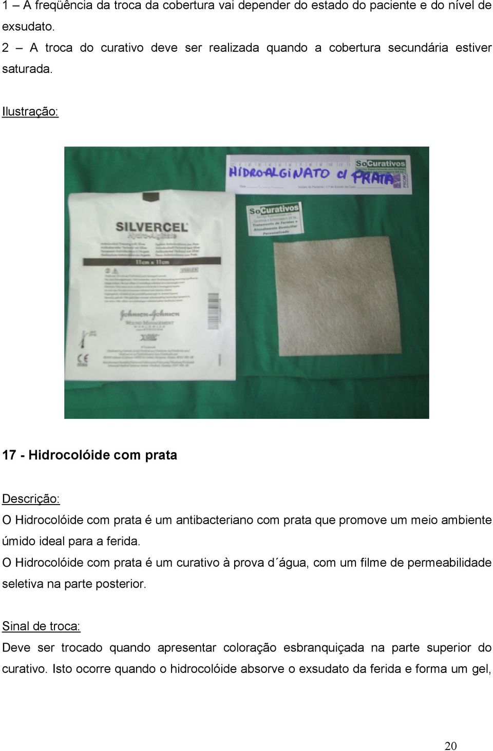 Ilustração: 17 - Hidrocolóide com prata O Hidrocolóide com prata é um antibacteriano com prata que promove um meio ambiente úmido ideal para a ferida.