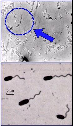 Bastonete Vibrião Espiroqueta Esquema de uma célula bacteriana Cápsula Substância mucilaginosa; Maioria das bactérias é de composição polissacarídica e em casos raros polímeros nitrogenados;