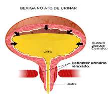 Manifestações Clínicas O principal sinal é a ausência de diurese pelo espaço de várias horas, assim como a distensão da bexiga, denominada de bexigoma.