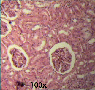 Forma arredondada ou alongada Diâmetro: 0,5 a 1 µm Comprimento: 0,5 a 10 µm