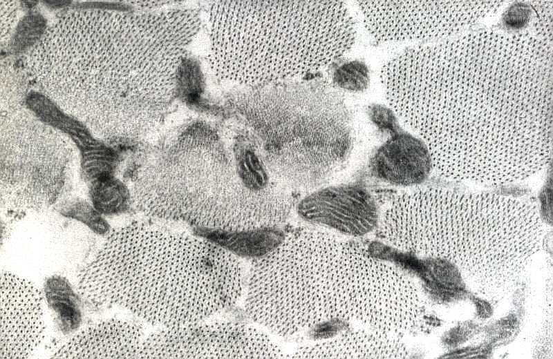 cílios Espermatozóides: ao redor do flagelo Músculo estriado: entre os feixes