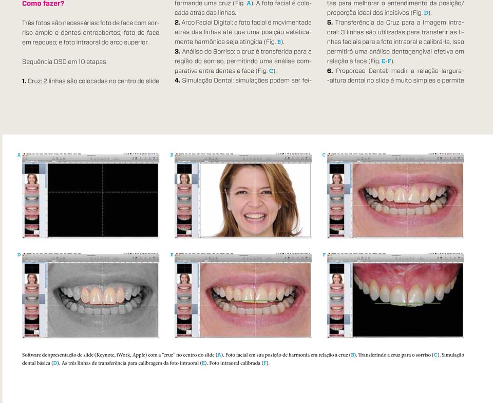 B). 3. Análise do Sorriso: a cruz é transferida para a região do sorriso, permitindo uma análise comparativa entre dentes e face (Fig. C). 4.