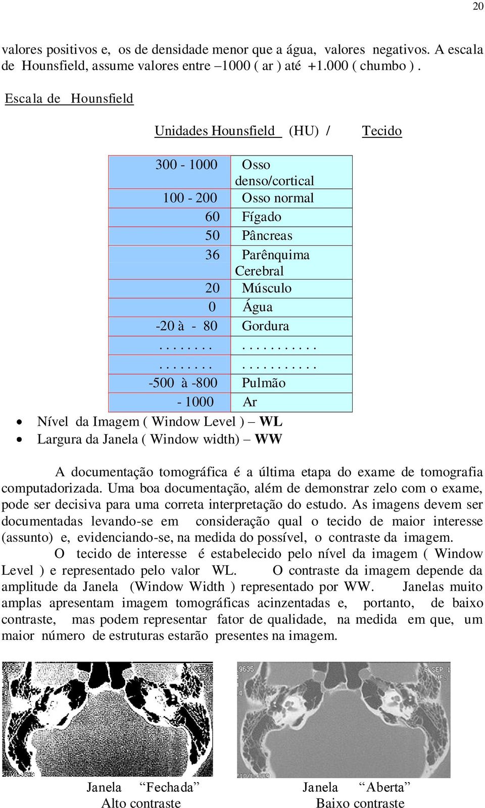 ..................................... -500 à -800 Pulmão - 1000 Ar Nível da Imagem ( Window Level ) WL Largura da Janela ( Window width) WW A documentação tomográfica é a última etapa do exame de tomografia computadorizada.