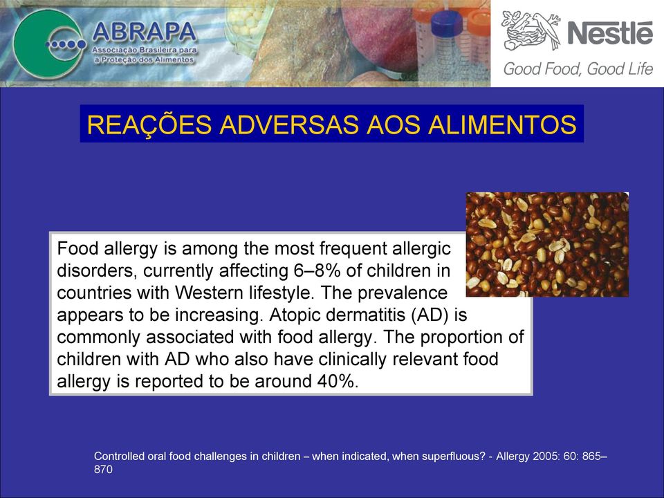 Atopic dermatitis (AD) is commonly associated with food allergy.