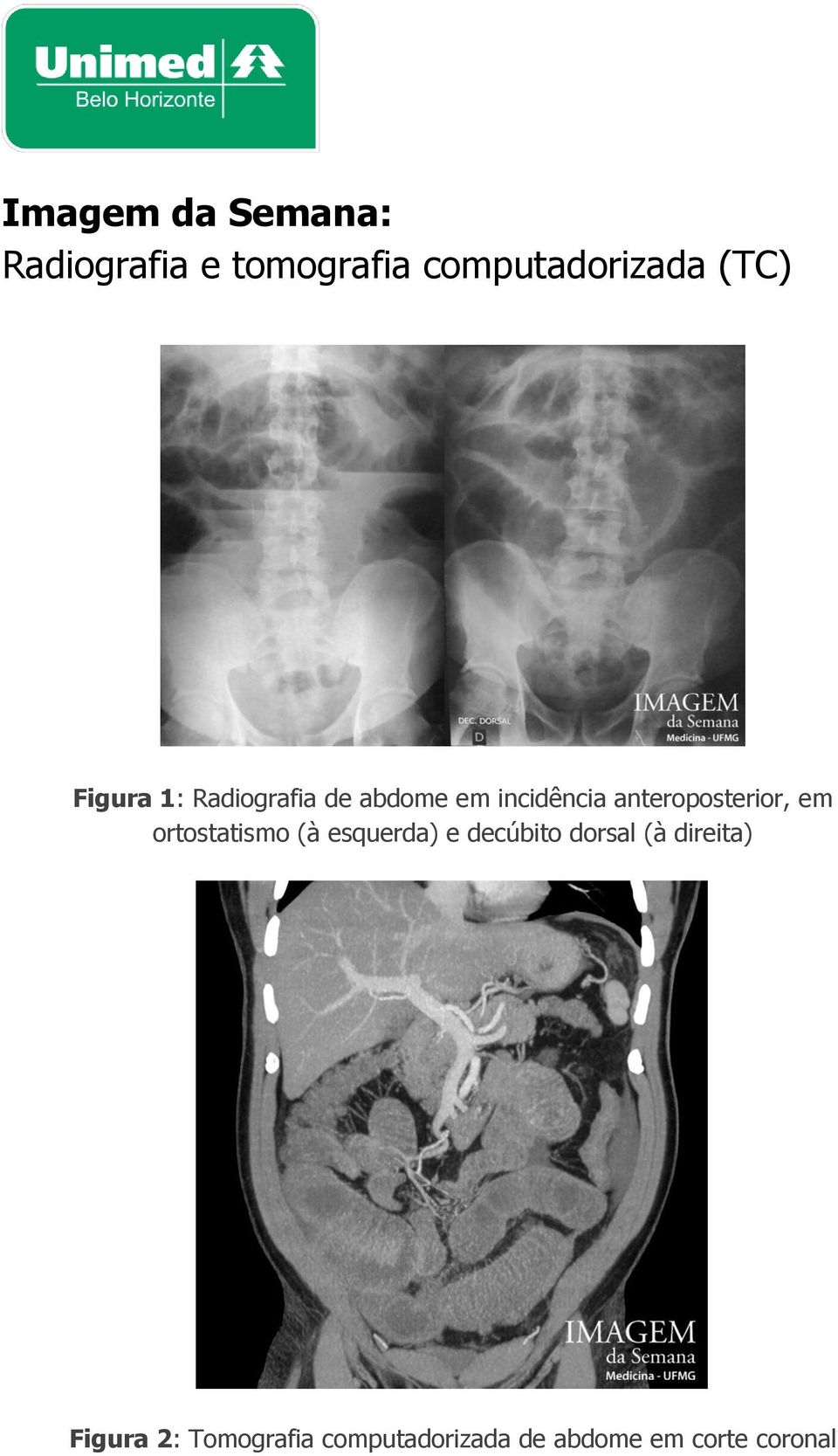 anteroposterior, em ortostatismo (à esquerda) e decúbito