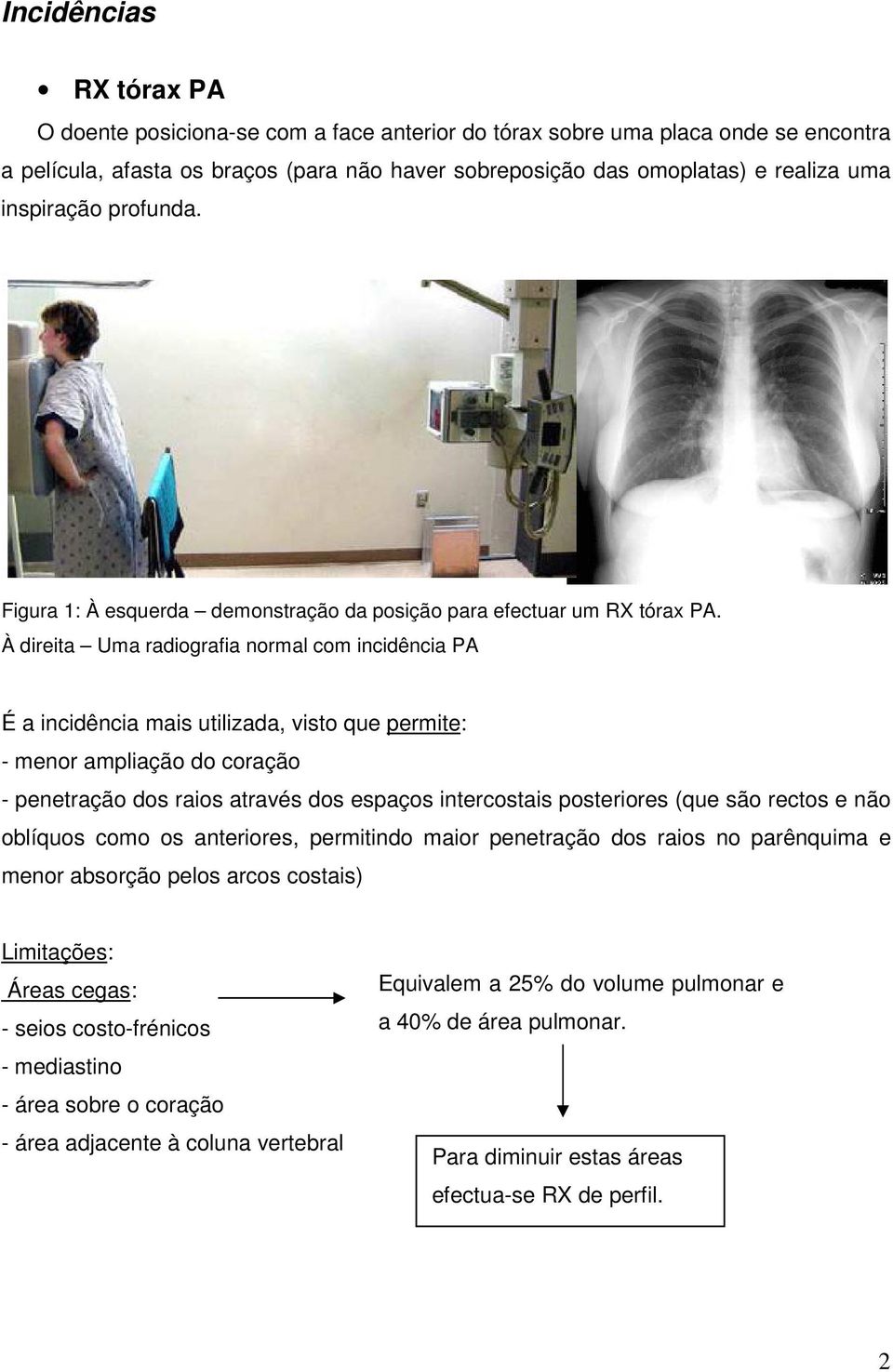 À direita Uma radiografia normal com incidência PA É a incidência mais utilizada, visto que permite: - menor ampliação do coração - penetração dos raios através dos espaços intercostais posteriores