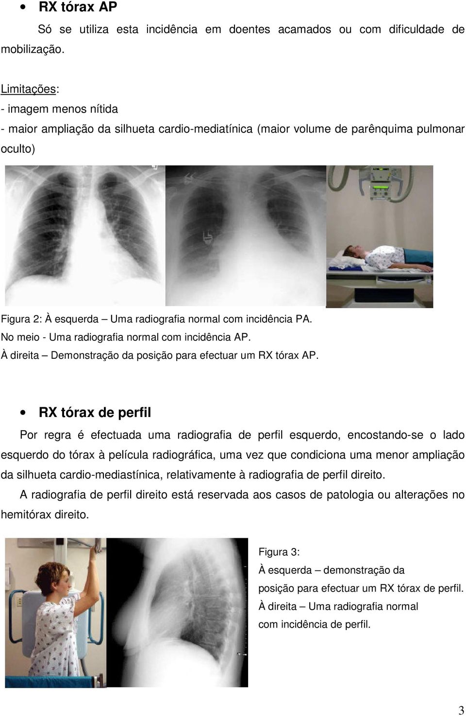 Figura 2: À esquerda Uma radiografia normal com incidência PA. No meio - Uma radiografia normal com incidência AP. À direita Demonstração da posição para efectuar um RX tórax AP.