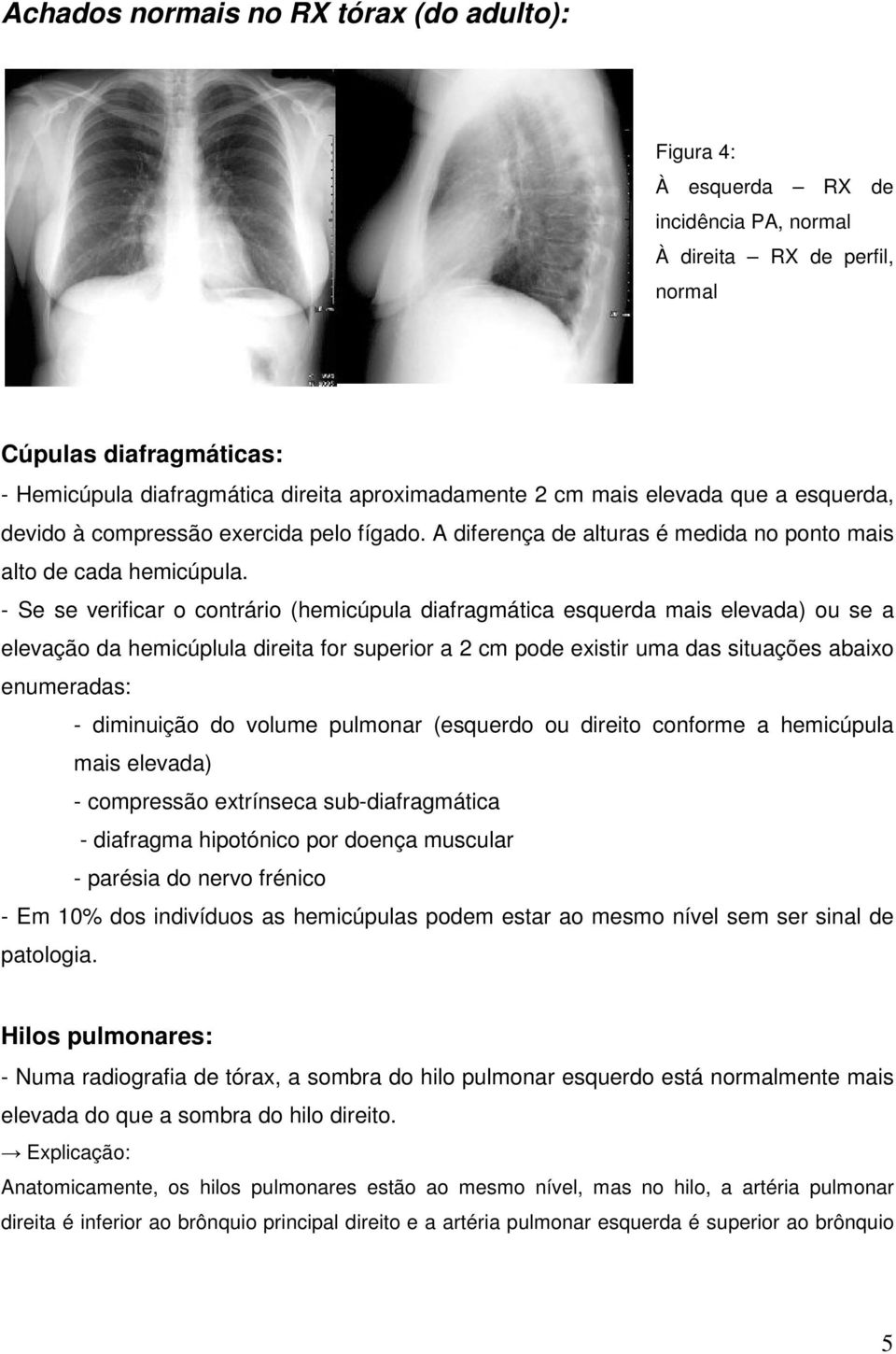 - Se se verificar o contrário (hemicúpula diafragmática esquerda mais elevada) ou se a elevação da hemicúplula direita for superior a 2 cm pode existir uma das situações abaixo enumeradas: -