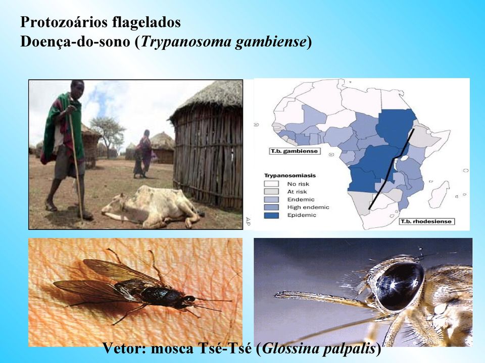 (Trypanosoma gambiense)