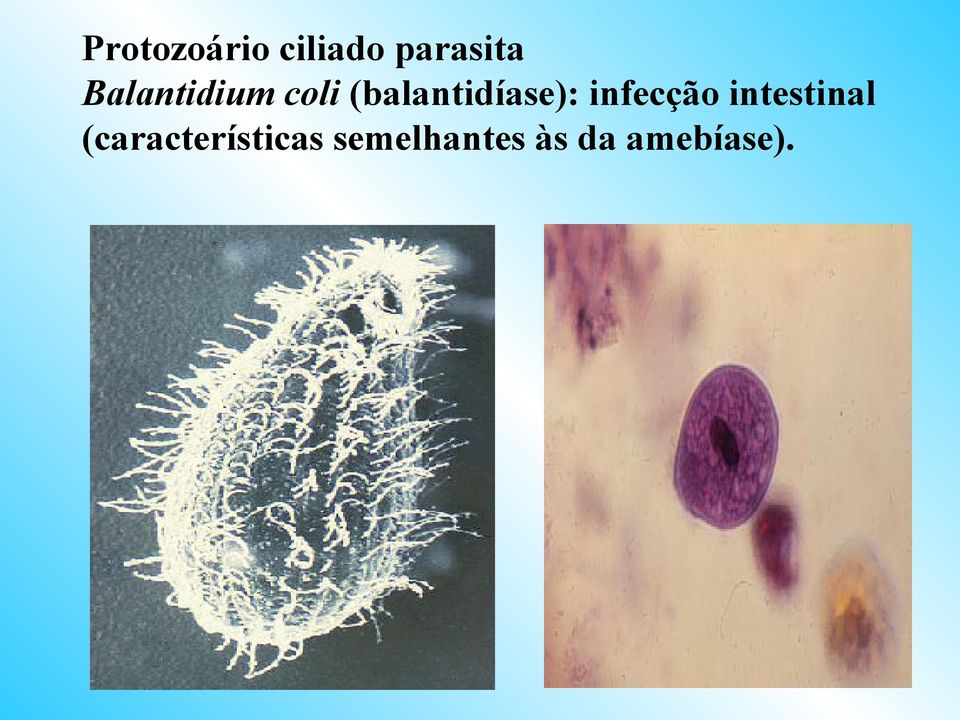 (balantidíase): infecção