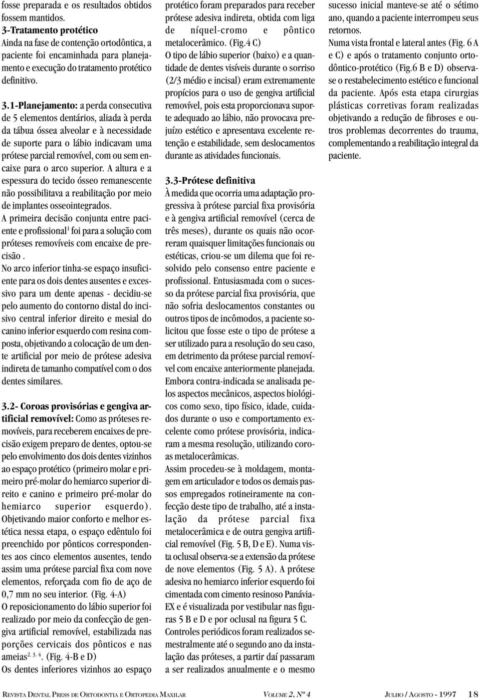 1-Planejamento: a perda consecutiva de 5 elementos dentários, aliada à perda da tábua óssea alveolar e à necessidade de suporte para o lábio indicavam uma prótese parcial removível, com ou sem