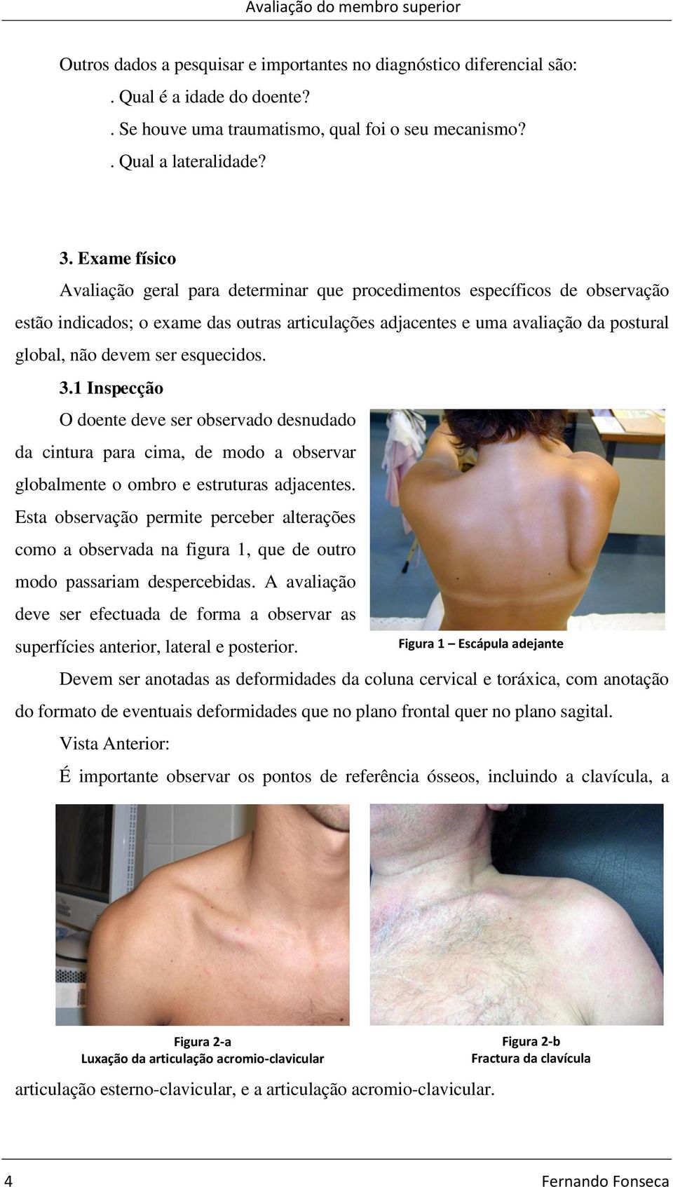 ser esquecidos. 3.1 Inspecção O doente deve ser observado desnudado da cintura para cima, de modo a observar globalmente o ombro e estruturas adjacentes.