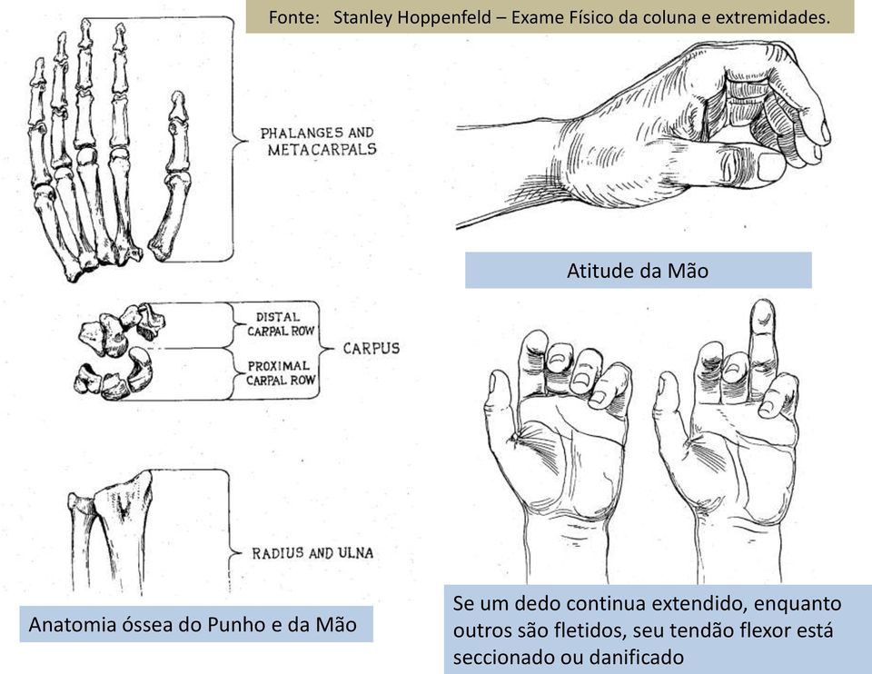 Atitude da Mão Anatomia óssea do Punho e da Mão Se um