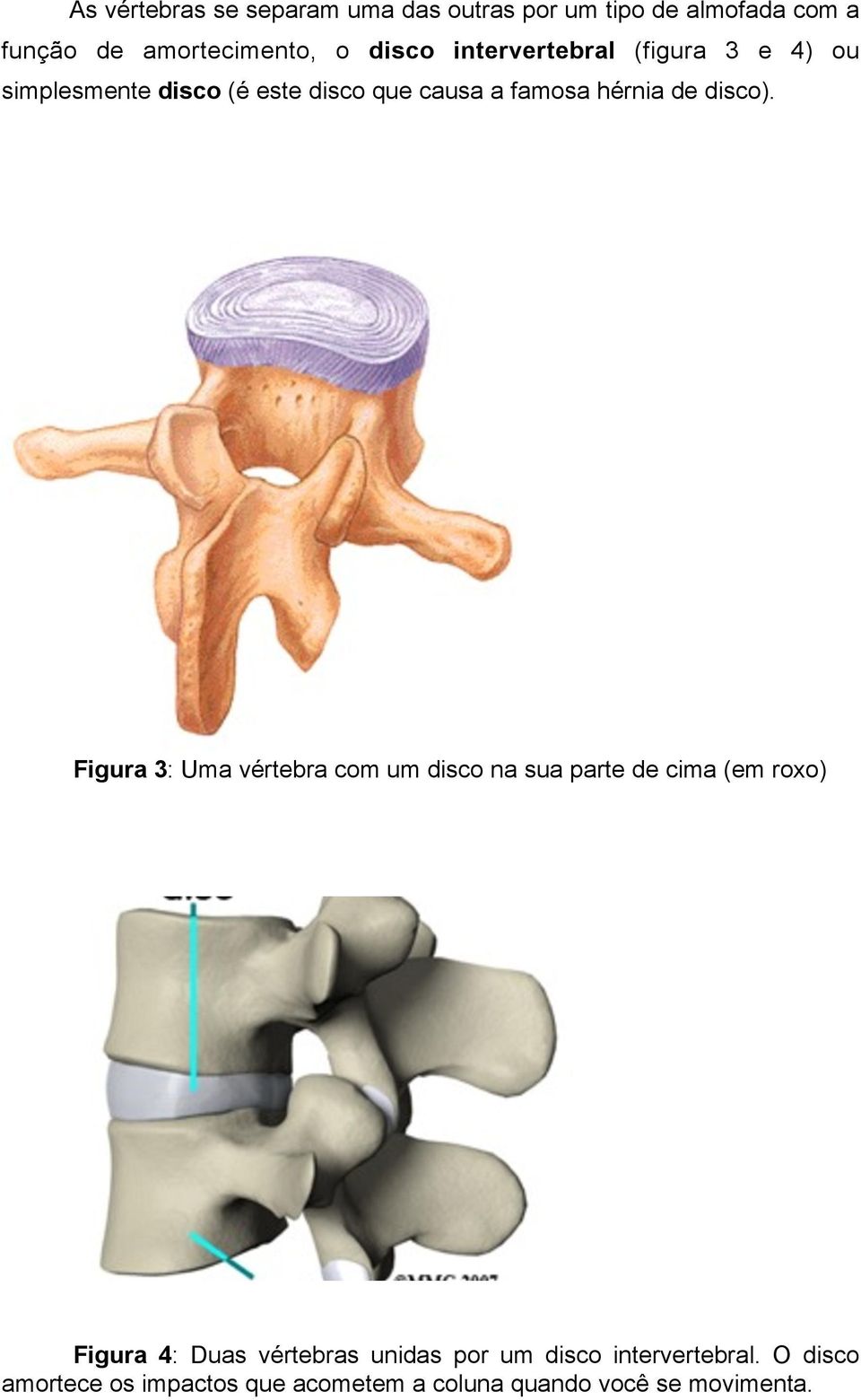 Figura 3: Uma vértebra com um disco na sua parte de cima (em roxo) Figura 4: Duas vértebras unidas por