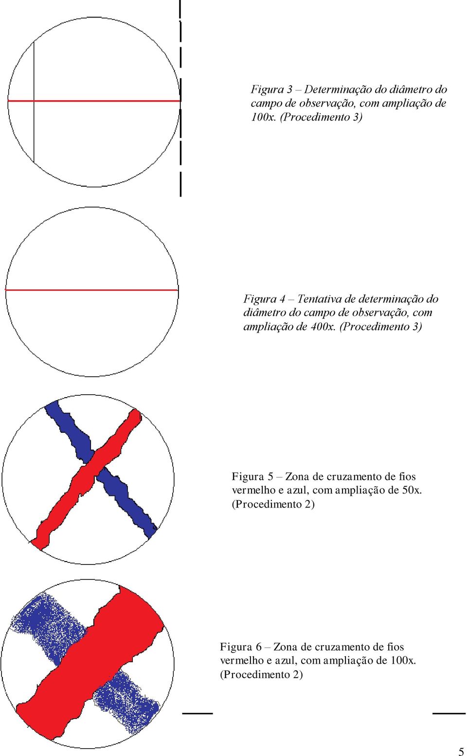 ampliação de 400x.