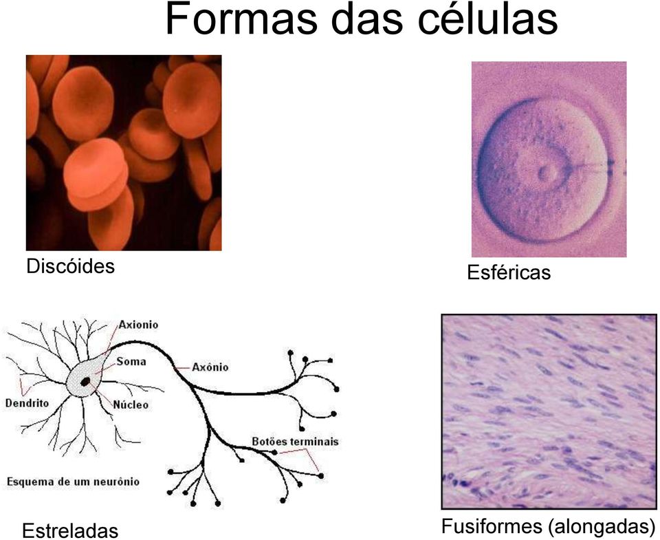 Esféricas