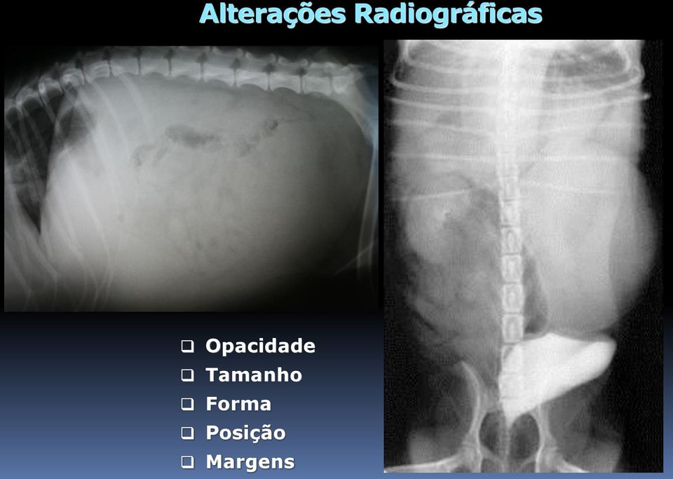 Opacidade