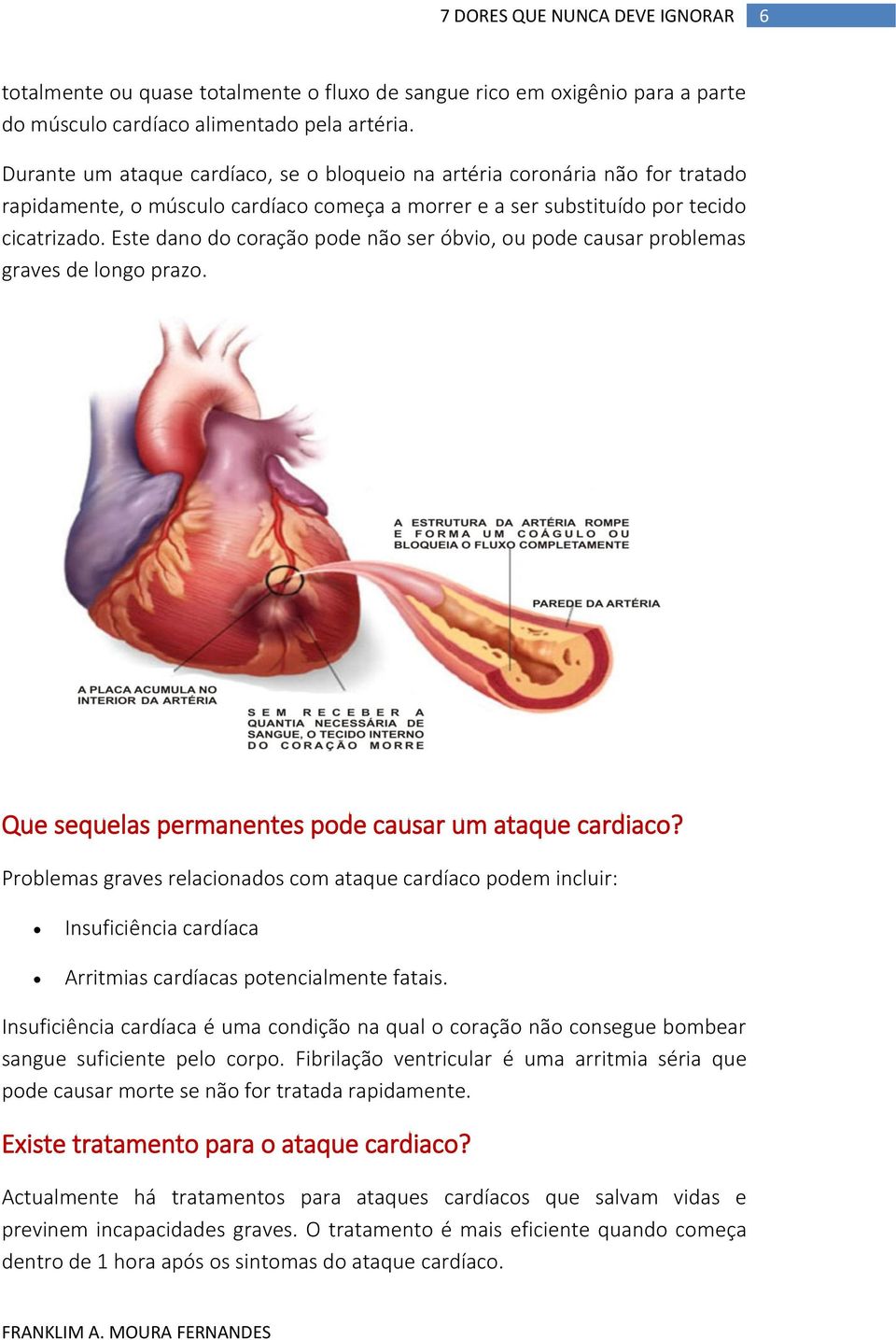 Este dano do coração pode não ser óbvio, ou pode causar problemas graves de longo prazo. Que sequelas permanentes pode causar um ataque cardiaco?