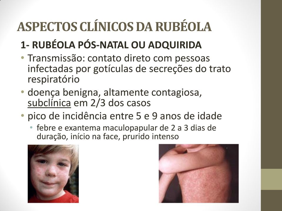 altamente contagiosa, subclínica em 2/3 dos casos pico de incidência entre 5 e 9 anos de